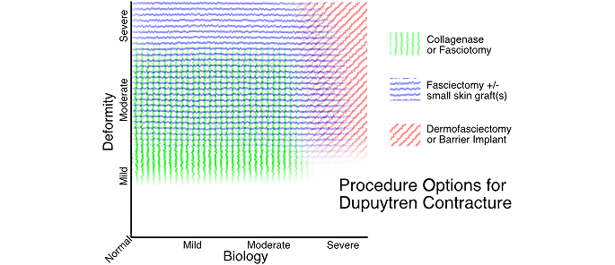 Dupuytren Contracture Procedure Choice